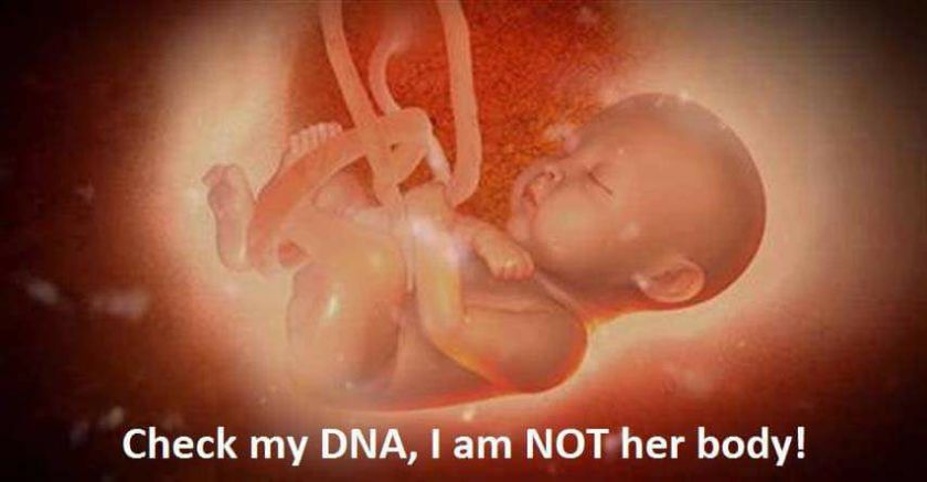 16299138_10207888342951366_8212374509091097604_n abortion my body